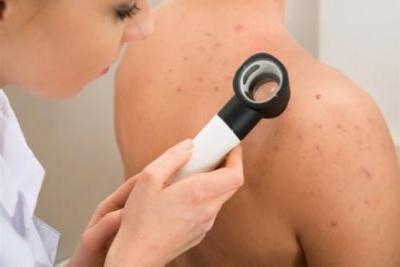 Dermoskopija u Ordinaciji Đukić - proverite sve mladeže na vreme 