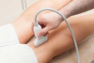 Kolor dopler krvnih sudova nogu uz D dimer