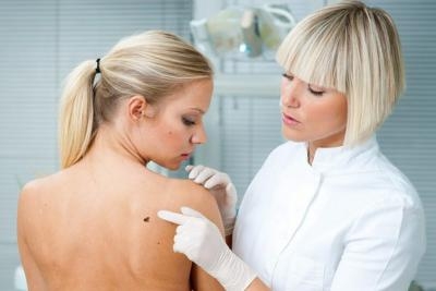 Pregled dermatologa i dermatoskopija svih mladeža po telu