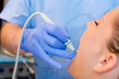 Uklanjanje kamenca, poliranje i peskiranje.Popusti