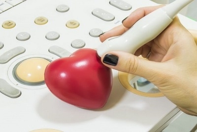  Ultrazvuk srca i EKG zapis sa interpretacijom