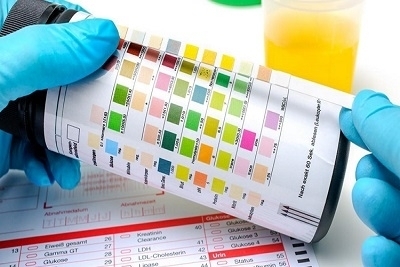 Urinokultura - Popusti